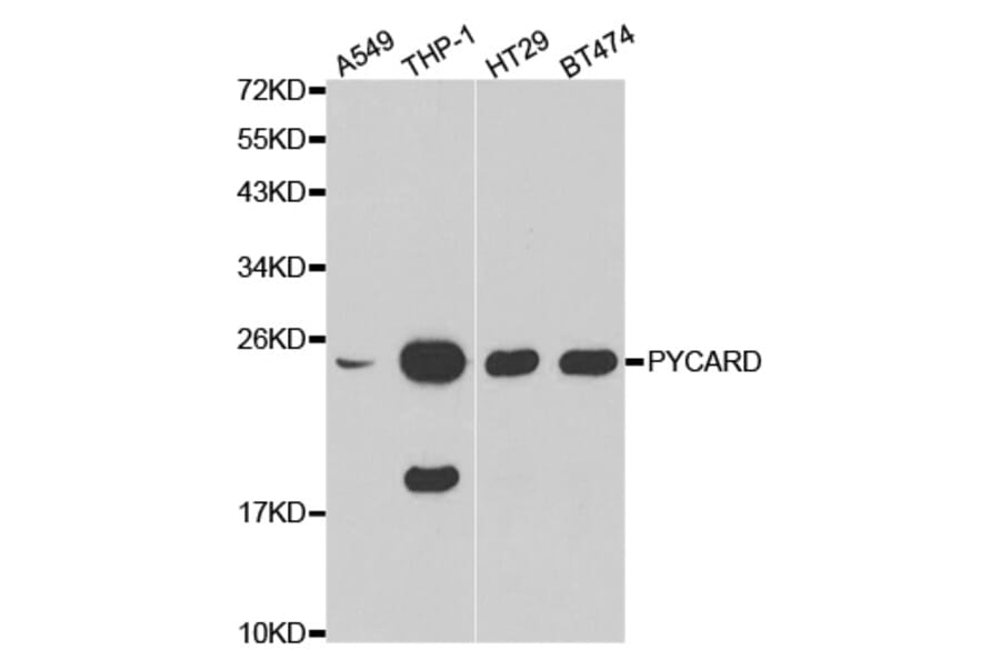 Western blot - PYCARD Antibody from Signalway Antibody (32200) - Antibodies.com
