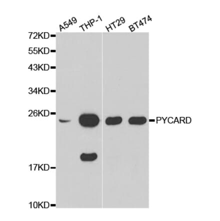 Western blot - PYCARD Antibody from Signalway Antibody (32200) - Antibodies.com