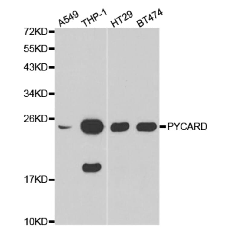 Western blot - PYCARD Antibody from Signalway Antibody (32200) - Antibodies.com