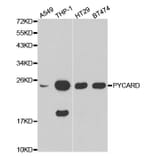 Western blot - PYCARD Antibody from Signalway Antibody (32200) - Antibodies.com