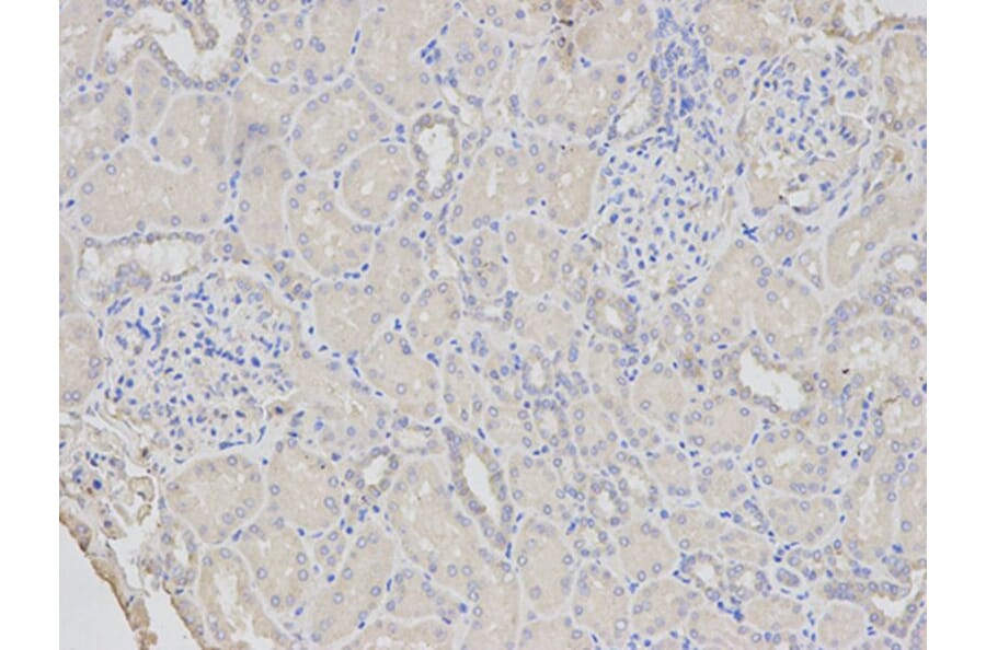Immunohistochemistry - PYCARD Antibody from Signalway Antibody (32200) - Antibodies.com