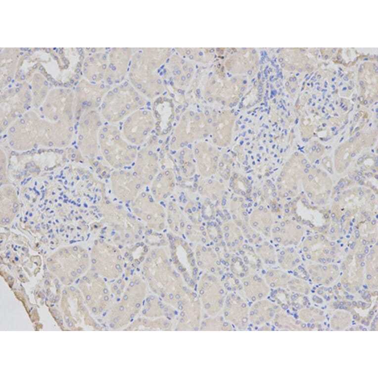 Immunohistochemistry - PYCARD Antibody from Signalway Antibody (32200) - Antibodies.com