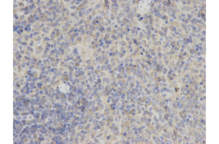 Immunohistochemistry - PYCARD Antibody from Signalway Antibody (32200) - Antibodies.com