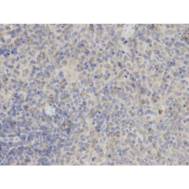 Immunohistochemistry - PYCARD Antibody from Signalway Antibody (32200) - Antibodies.com