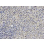 Immunohistochemistry - PYCARD Antibody from Signalway Antibody (32200) - Antibodies.com