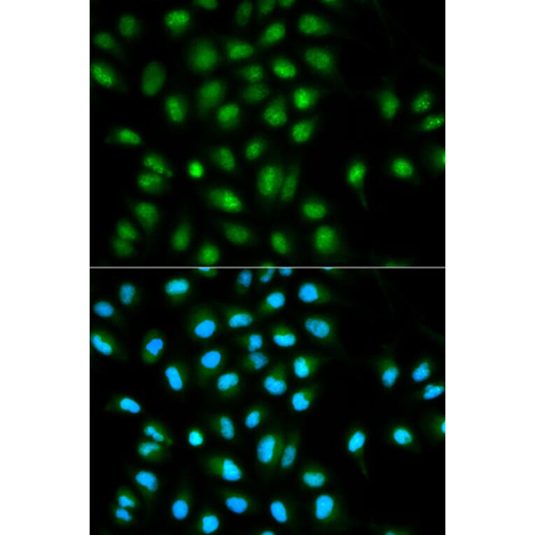 Immunofluorescence - PYCARD Antibody from Signalway Antibody (32200) - Antibodies.com