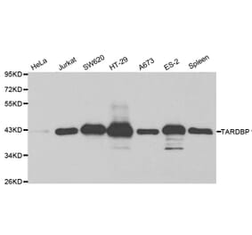 Western blot - TARDBP Antibody from Signalway Antibody (32210) - Antibodies.com