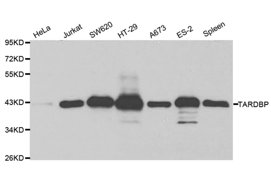 Western blot - TARDBP Antibody from Signalway Antibody (32210) - Antibodies.com