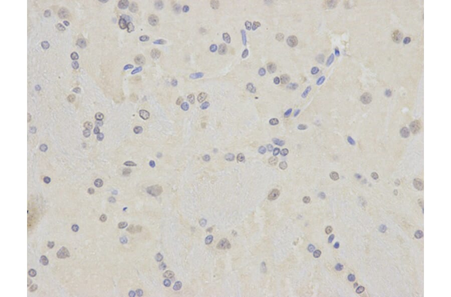 Immunohistochemistry - TARDBP Antibody from Signalway Antibody (32210) - Antibodies.com