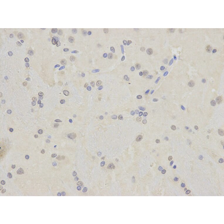 Immunohistochemistry - TARDBP Antibody from Signalway Antibody (32210) - Antibodies.com