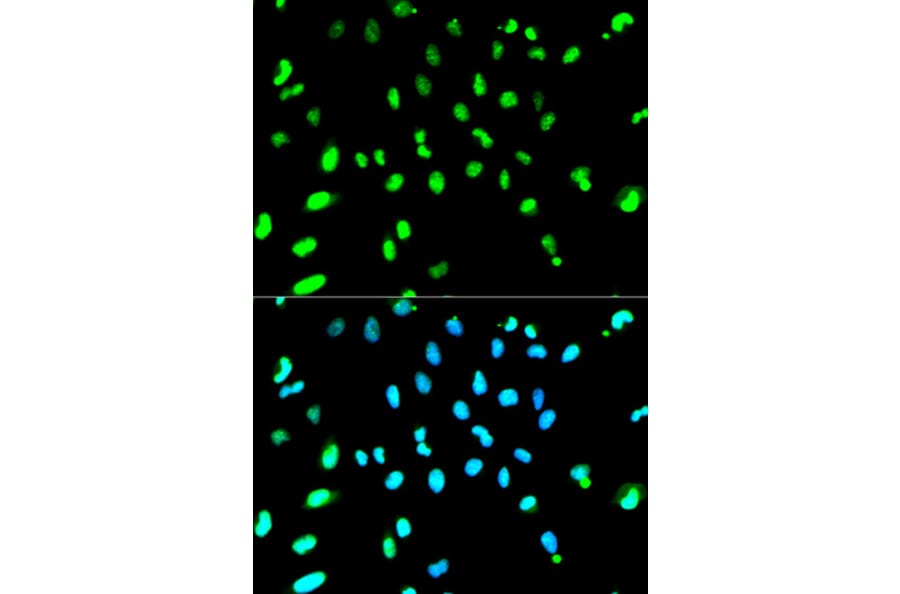 Immunofluorescence - TARDBP Antibody from Signalway Antibody (32210) - Antibodies.com