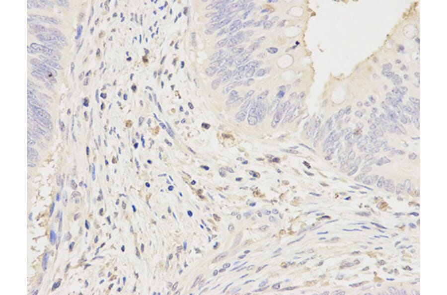 Immunohistochemistry - FCGR1A Antibody from Signalway Antibody (32221) - Antibodies.com