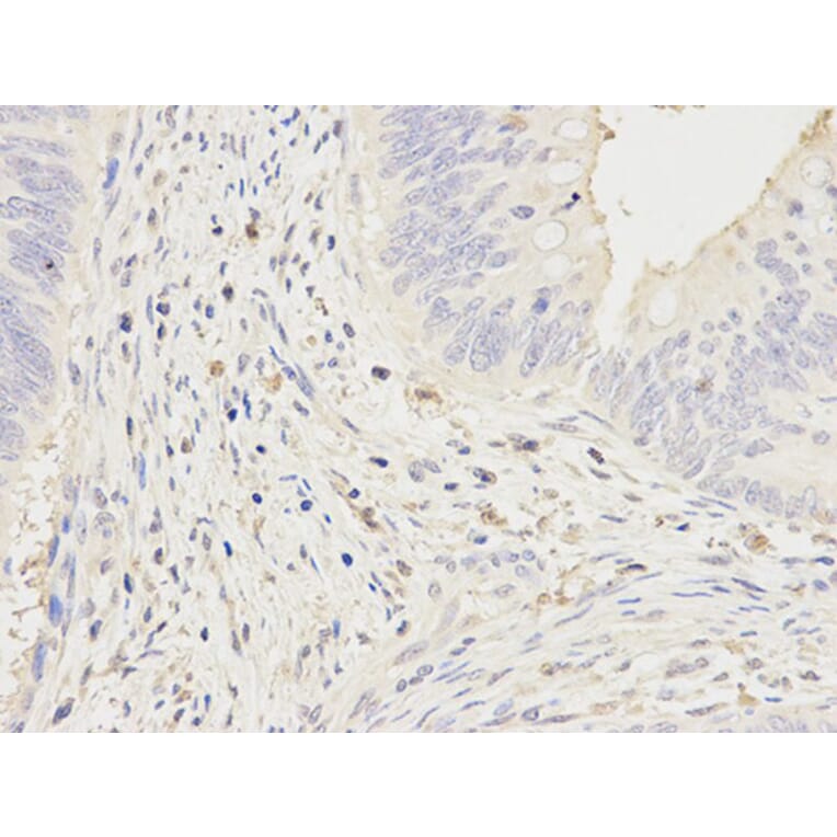 Immunohistochemistry - FCGR1A Antibody from Signalway Antibody (32221) - Antibodies.com
