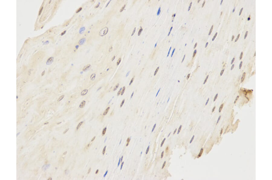 Immunohistochemistry - FCGR1A Antibody from Signalway Antibody (32221) - Antibodies.com