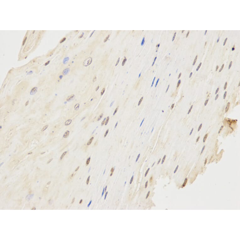 Immunohistochemistry - FCGR1A Antibody from Signalway Antibody (32221) - Antibodies.com