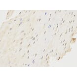 Immunohistochemistry - FCGR1A Antibody from Signalway Antibody (32221) - Antibodies.com