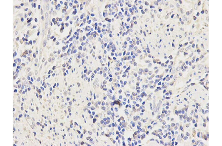 Immunohistochemistry - FCGR1A Antibody from Signalway Antibody (32221) - Antibodies.com