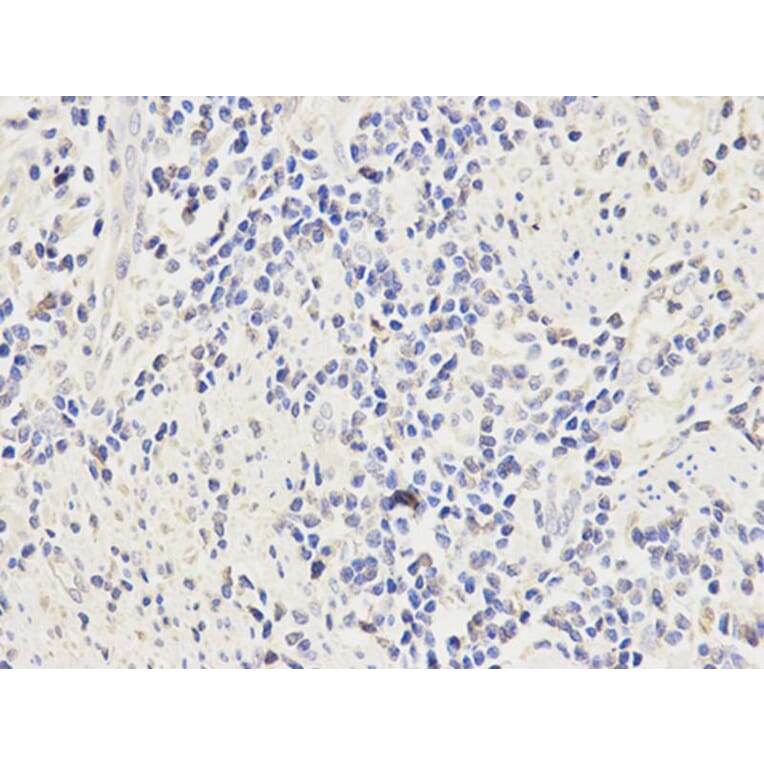 Immunohistochemistry - FCGR1A Antibody from Signalway Antibody (32221) - Antibodies.com