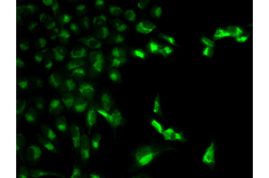 Immunofluorescence - FCGR1A Antibody from Signalway Antibody (32221) - Antibodies.com