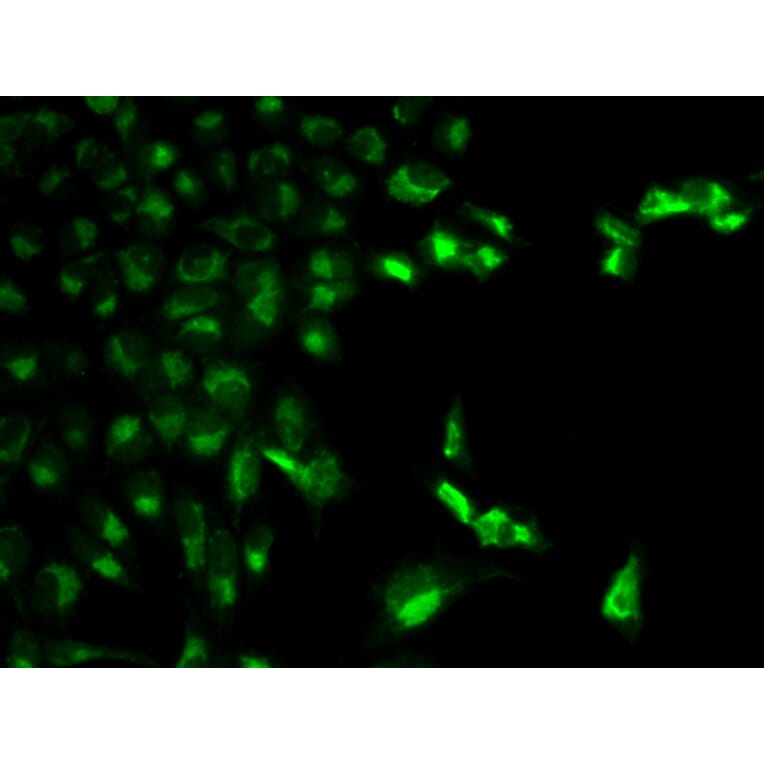 Immunofluorescence - FCGR1A Antibody from Signalway Antibody (32221) - Antibodies.com