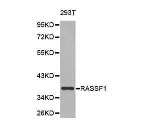 Western blot - RASSF1 Antibody from Signalway Antibody (32226) - Antibodies.com