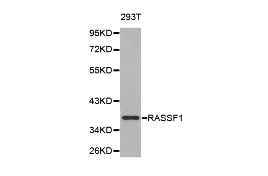 Western blot - RASSF1 Antibody from Signalway Antibody (32226) - Antibodies.com