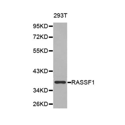 Western blot - RASSF1 Antibody from Signalway Antibody (32226) - Antibodies.com