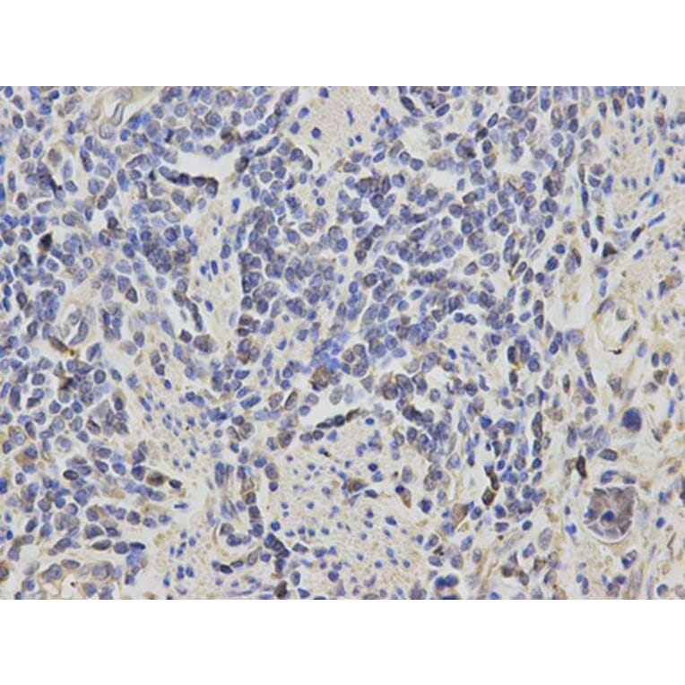Immunohistochemistry - RASSF1 Antibody from Signalway Antibody (32226) - Antibodies.com