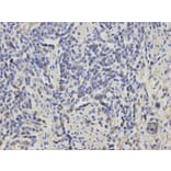 Immunohistochemistry - RASSF1 Antibody from Signalway Antibody (32226) - Antibodies.com