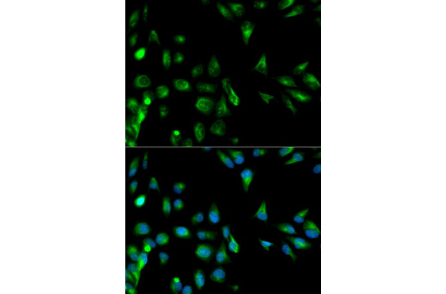 Immunofluorescence - RASSF1 Antibody from Signalway Antibody (32226) - Antibodies.com