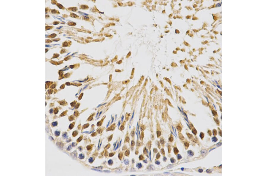 Immunohistochemistry - NFE2L2 Antibody from Signalway Antibody (32254) - Antibodies.com