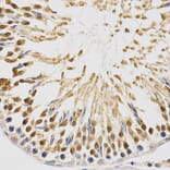 Immunohistochemistry - NFE2L2 Antibody from Signalway Antibody (32254) - Antibodies.com