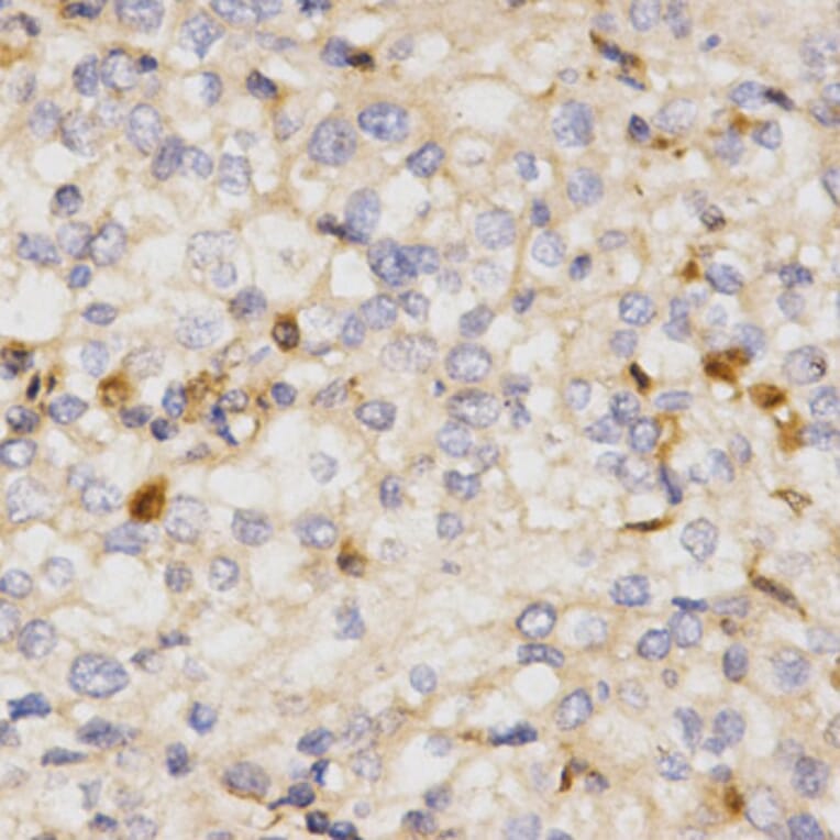 Immunohistochemistry - NFE2L2 Antibody from Signalway Antibody (32254) - Antibodies.com