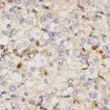 Immunohistochemistry - NFE2L2 Antibody from Signalway Antibody (32254) - Antibodies.com