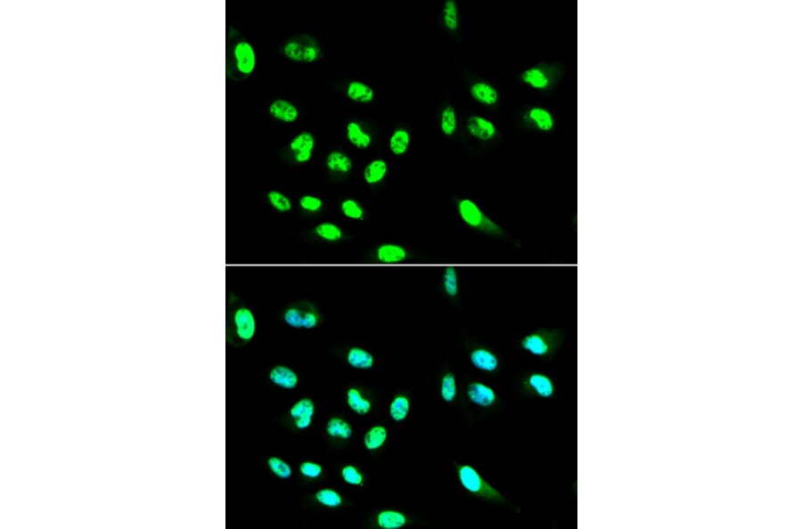 Immunofluorescence - FCGR2A Antibody from Signalway Antibody (32270) - Antibodies.com