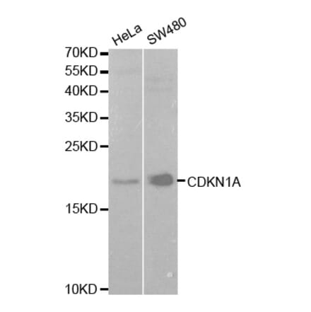 Western blot - CDKN1A Antibody from Signalway Antibody (32286) - Antibodies.com