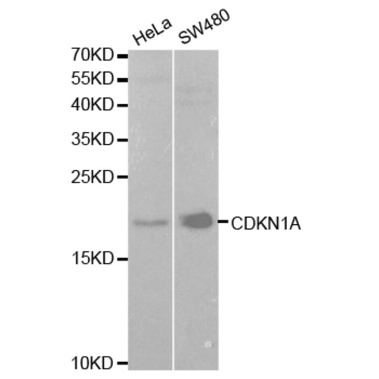 Western blot - CDKN1A Antibody from Signalway Antibody (32286) - Antibodies.com