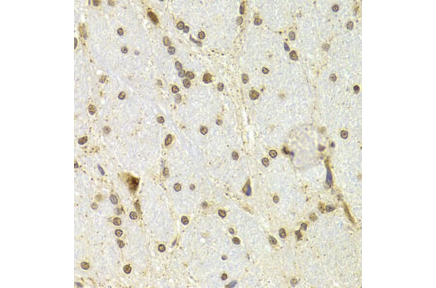 Immunohistochemistry - CDKN1A Antibody from Signalway Antibody (32286) - Antibodies.com