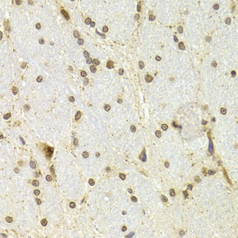Immunohistochemistry - CDKN1A Antibody from Signalway Antibody (32286) - Antibodies.com