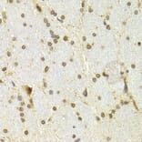 Immunohistochemistry - CDKN1A Antibody from Signalway Antibody (32286) - Antibodies.com