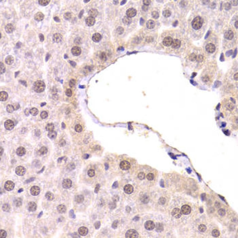 Immunohistochemistry - CDKN1A Antibody from Signalway Antibody (32286) - Antibodies.com