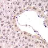 Immunohistochemistry - CDKN1A Antibody from Signalway Antibody (32286) - Antibodies.com