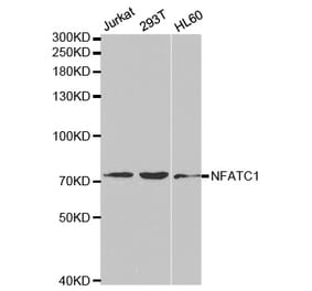Western blot - NFATC1 Antibody from Signalway Antibody (32303) - Antibodies.com