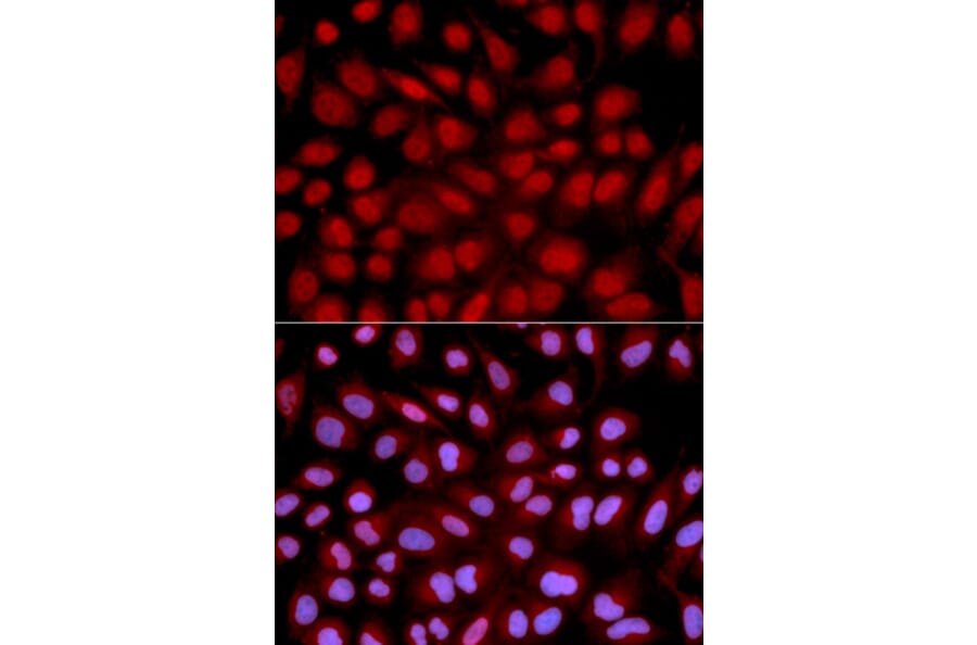 Immunofluorescence - NFATC1 Antibody from Signalway Antibody (32303) - Antibodies.com