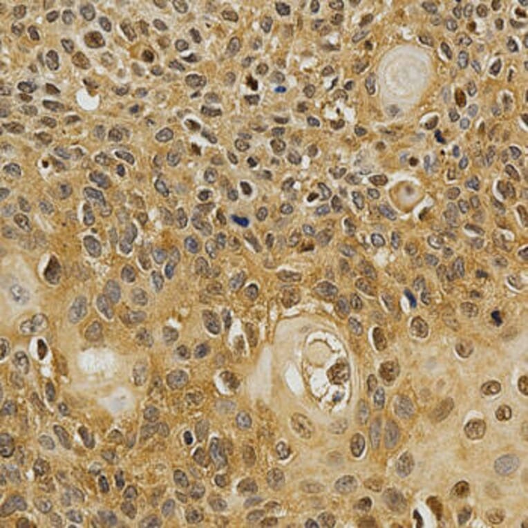 Immunohistochemistry - NFATC1 Antibody from Signalway Antibody (32303) - Antibodies.com