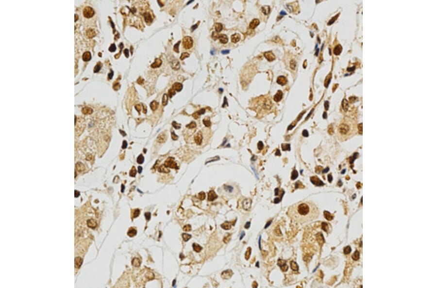 Immunohistochemistry - NFATC1 Antibody from Signalway Antibody (32303) - Antibodies.com