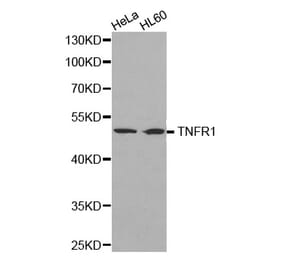 Western blot - TNF-R1 Antibody from Signalway Antibody (32304) - Antibodies.com