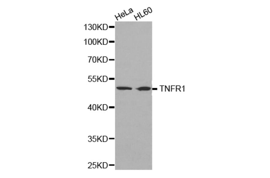 Western blot - TNF-R1 Antibody from Signalway Antibody (32304) - Antibodies.com