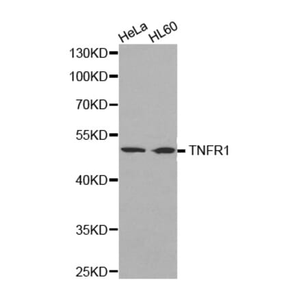 Western blot - TNF-R1 Antibody from Signalway Antibody (32304) - Antibodies.com
