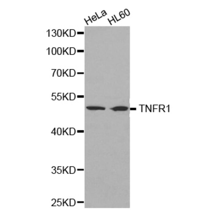 Western blot - TNF-R1 Antibody from Signalway Antibody (32304) - Antibodies.com